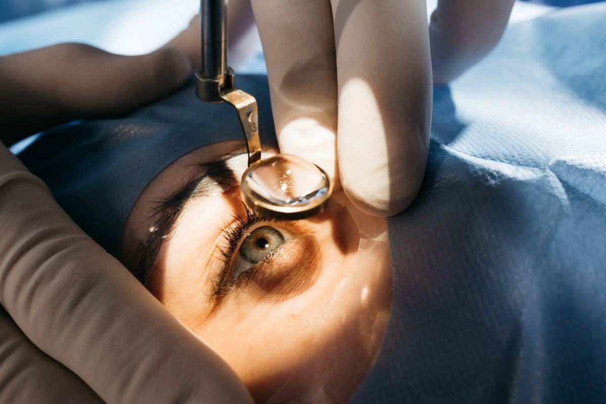 cataract eye surger 50kb
